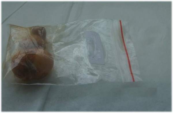 Method for preserving oxalis seed ball